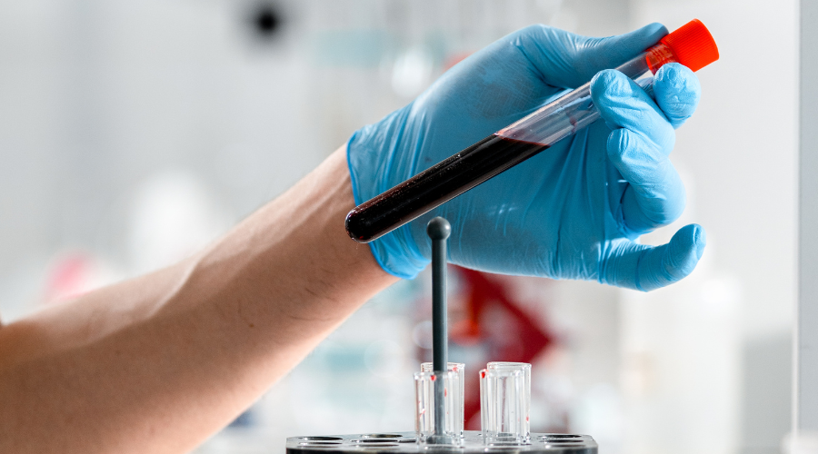 O que a Ciência Descobriu Sobre o Sangue Menstrual